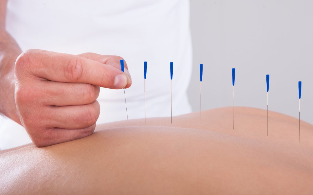 Acupuncture in Toronto: Helping You Shed Off the Unhealthy Weight