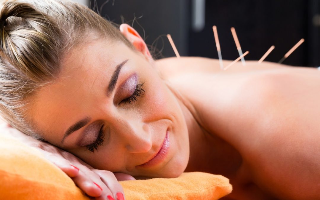 Some Things to Know When Selecting an Acupuncture Expert in Toronto